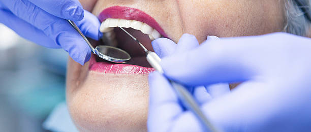 Best Knocked-Out Tooth Emergency  in Deer Park, IL